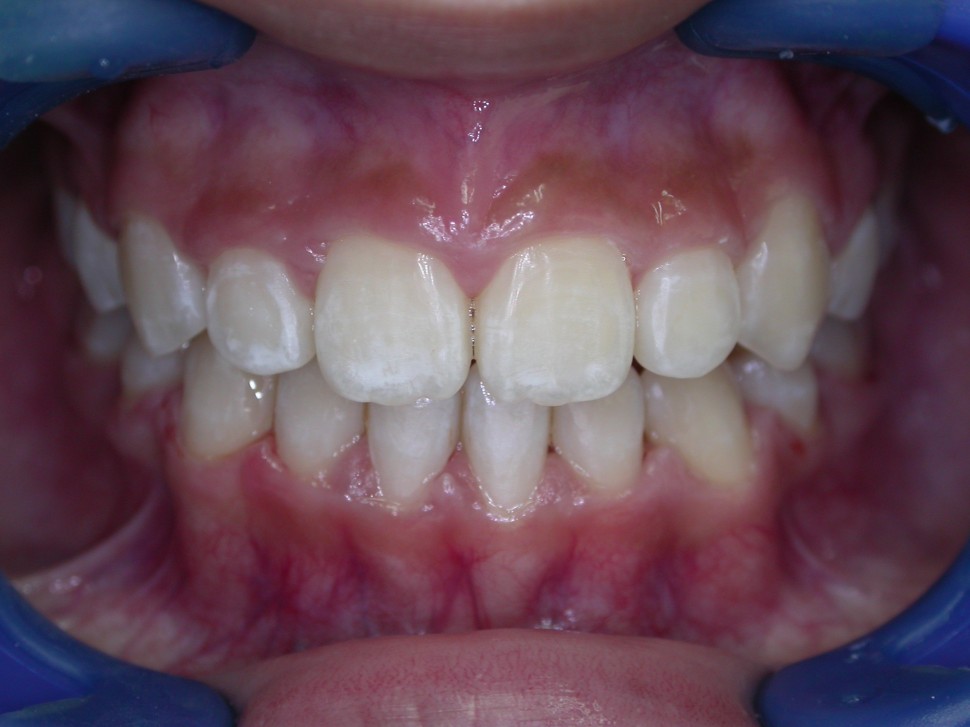 Orthodontics Yap & Associates Dental Surgery, Kuala Lumpur, Malaysia