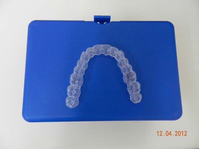 Invisalign