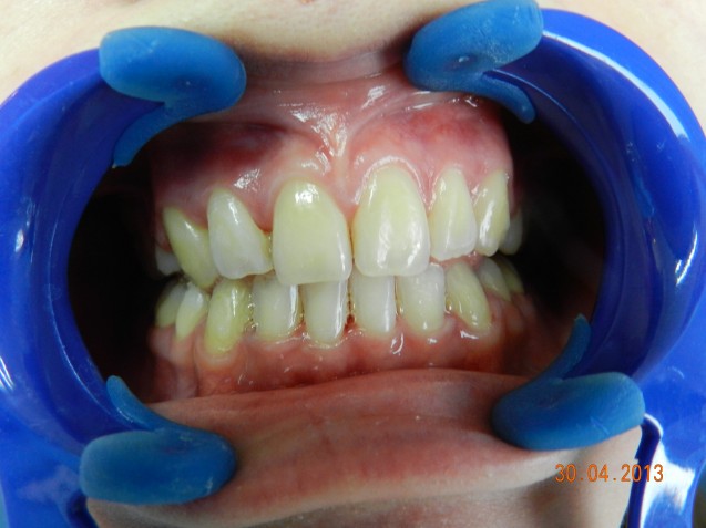 Orthodontic patient #3, after