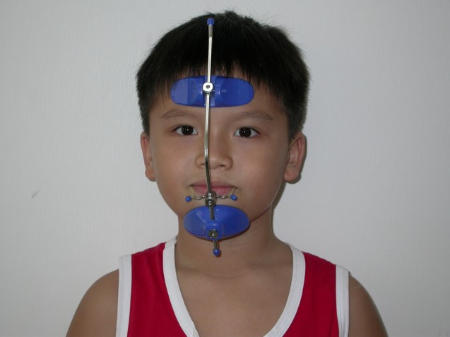 Reverse Pull Headgear