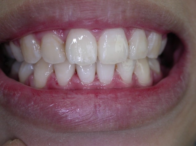Ortho Smile #6