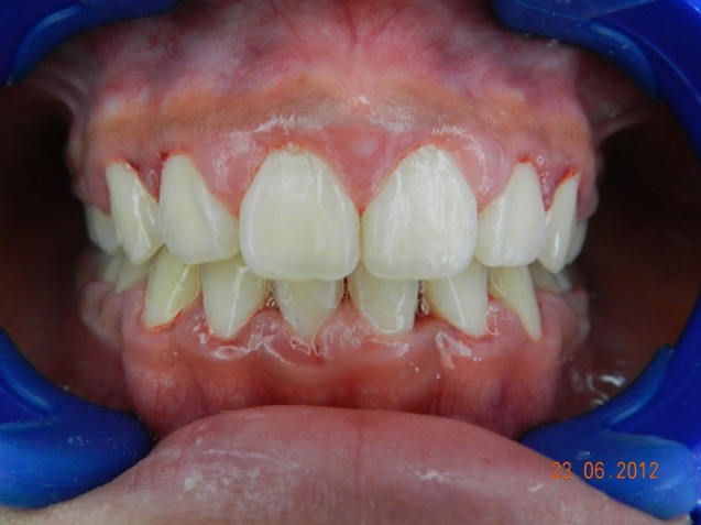 Ortho Smile #8