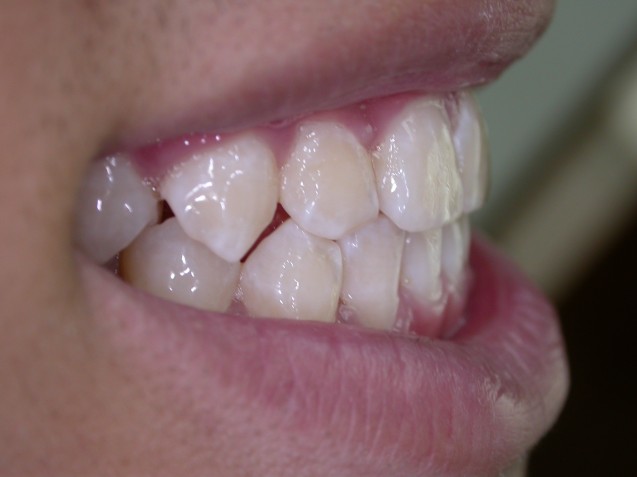 Ortho Smile #2