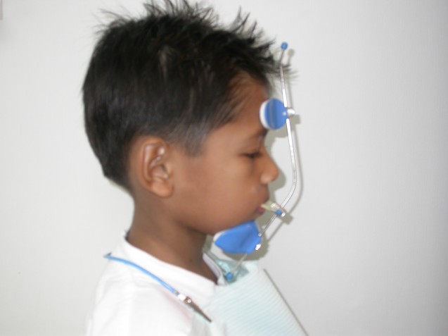 Reverse Pull Headgear